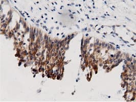 AK5 / Adenylate Kinase 5 Antibody (clone OTI2F9)