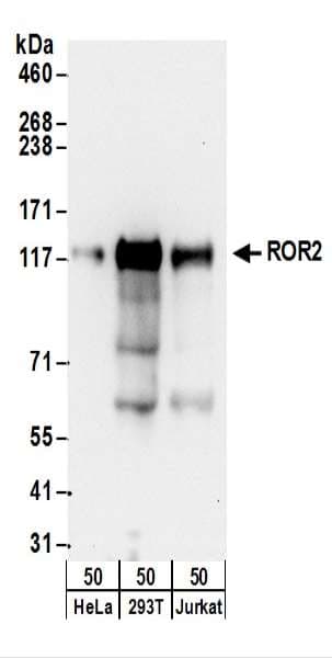 ROR2 Antibody (aa893-943)