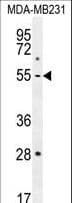 Polyclonal Rabbit anti-Human MMP1 Antibody (aa317-347, IHC, IF, WB)