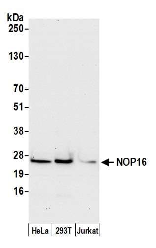 NOP16 Antibody (aa75-125)
