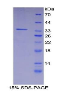Mouse CARD9 Protein (Recombinant His-T7)