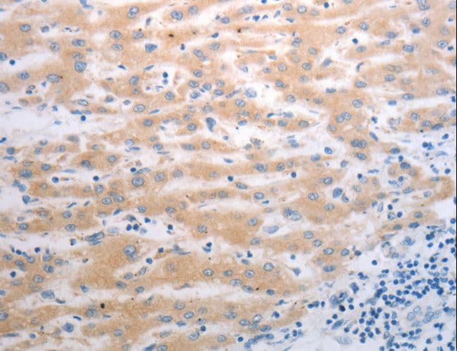 Polyclonal Rabbit anti-Human PAK1 Antibody (IHC, WB)