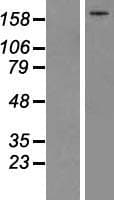 Human Complement C5 Protein (Over-Expression Lysate Myc-DDK (Flag))