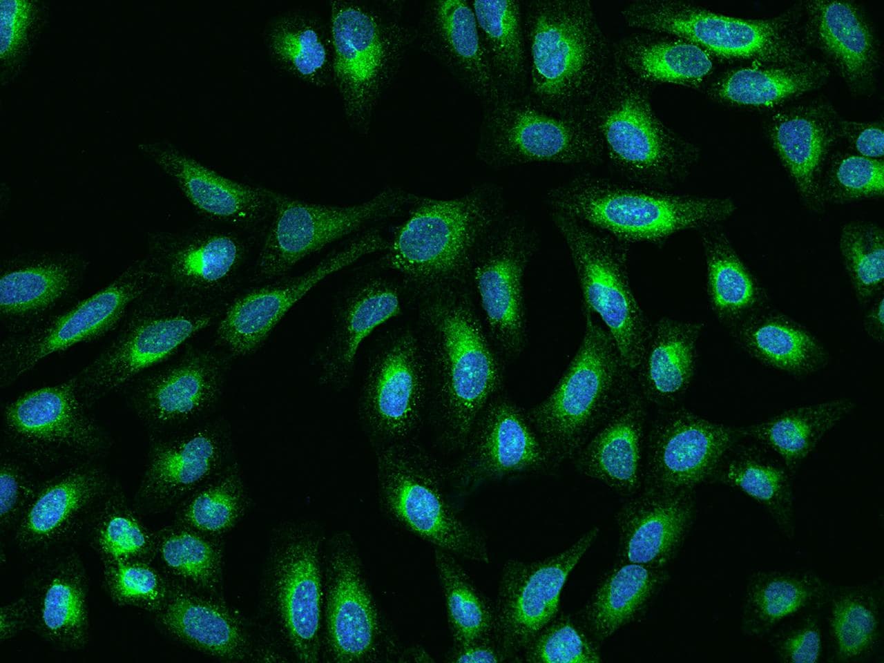 DERL1 / Derlin 1 Antibody