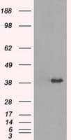 TRIB2 Antibody (clone OTI8D11)