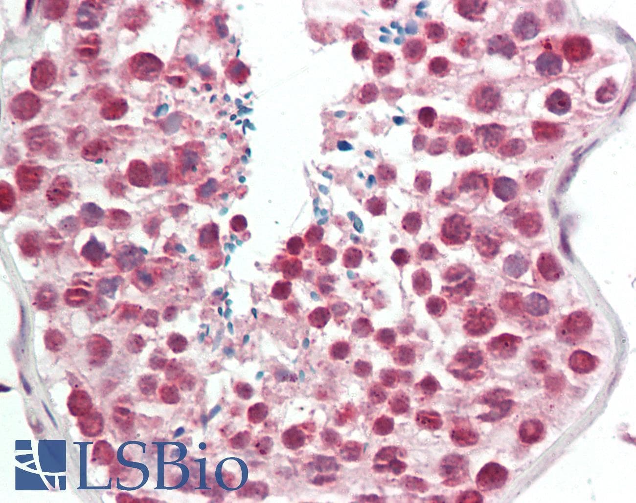 OS9 Antibody (Internal, DY650)