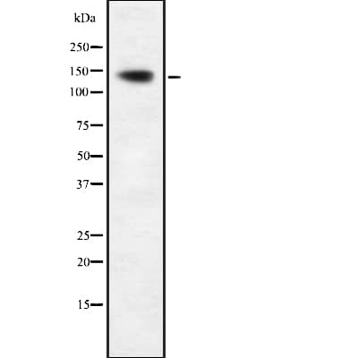 AATK / AATYK Antibody