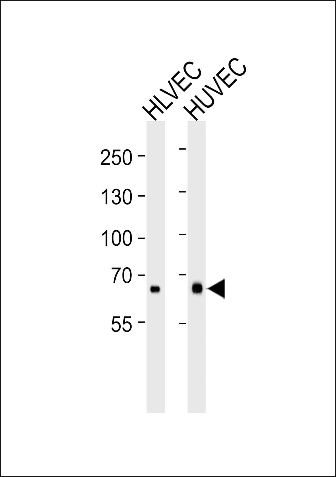 MMRN1 Antibody (aa179-207)