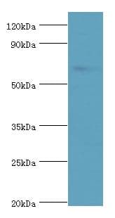 Polyclonal Rabbit anti-Human TAF1B Antibody (aa369-588, IHC, WB)