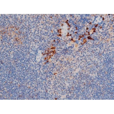 CDC25A Antibody (phospho-Ser75)