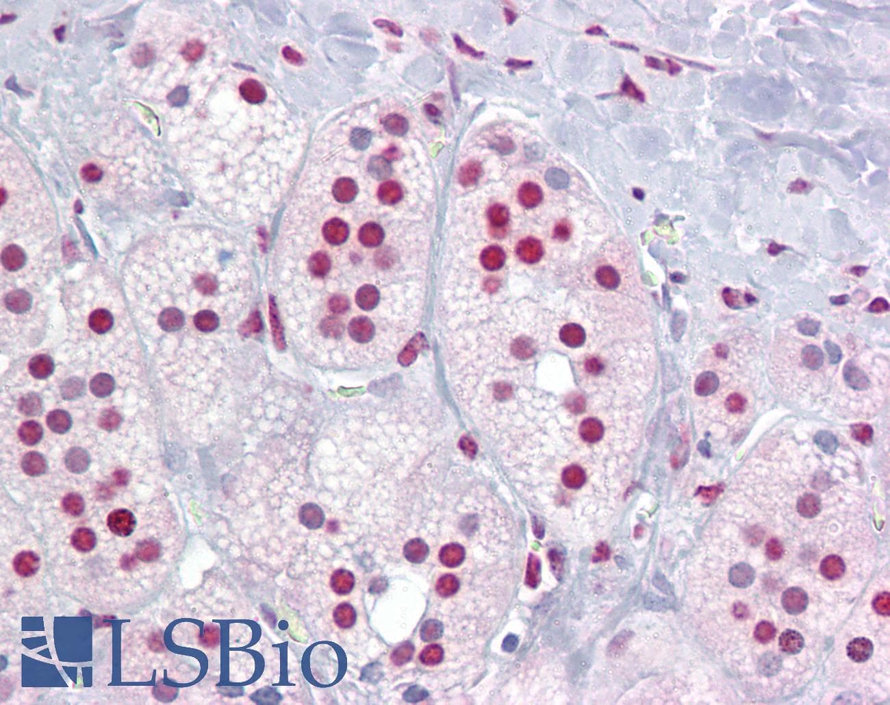 RORA / ROR Alpha Antibody (aa36-85)