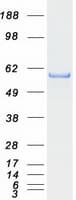 Human TRIM68 Protein (Recombinant Myc-DDK (Flag))