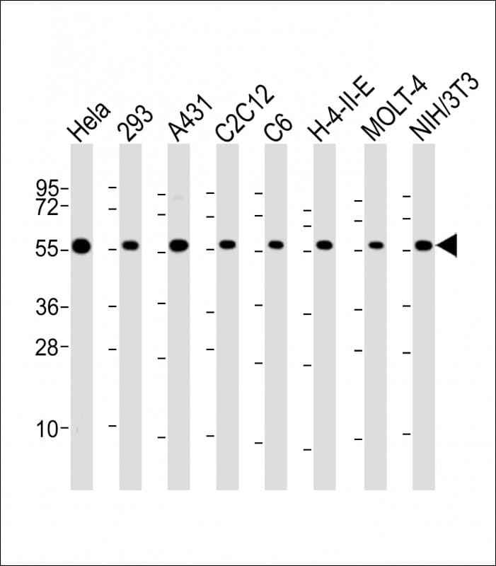 Polyclonal Rabbit anti-Human RAD21 Antibody (C-Terminus, WB)