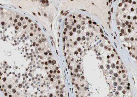 Polyclonal Rabbit anti-Human ESR2 / ER Beta Antibody (aa94-118, IHC, IF, WB)