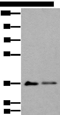 MAP1D Antibody