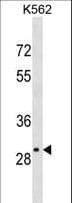 OR4S2 Antibody (aa206-233)