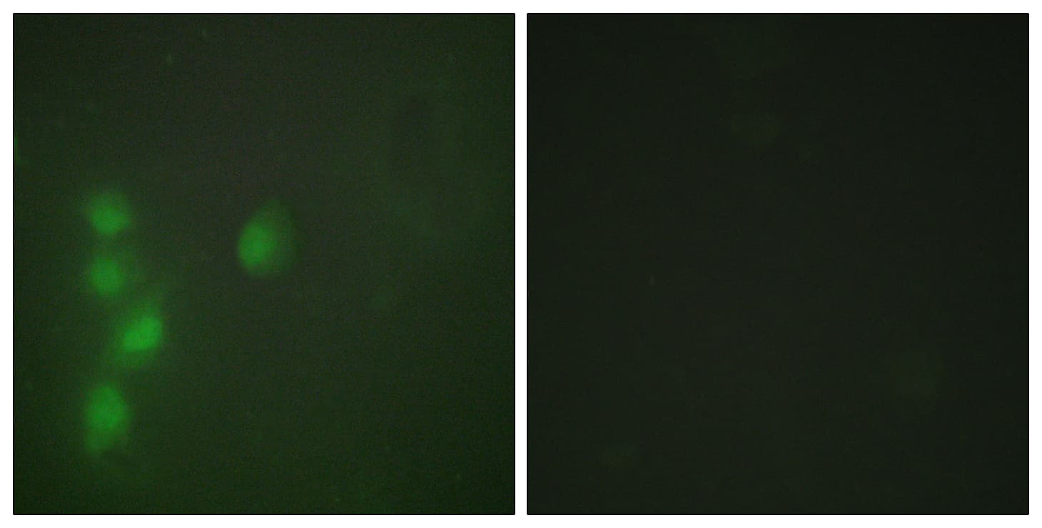 ZNF174 Antibody (aa201-250)