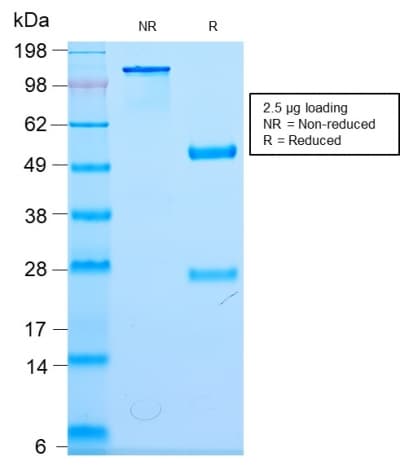 PathPlus™ NF-L / NEFL Antibody (clone NEFL/2983R)