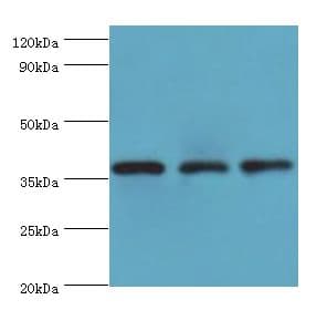 STRAP / MAWD Antibody (aa1-350)
