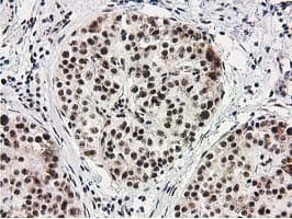 MGLL / Monoacylglycerol Lipase Antibody (clone OTI2B11)