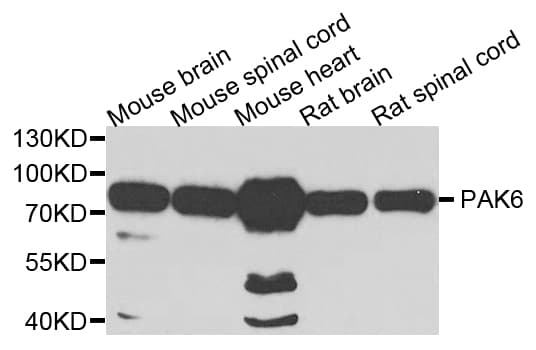 PAK6 Antibody