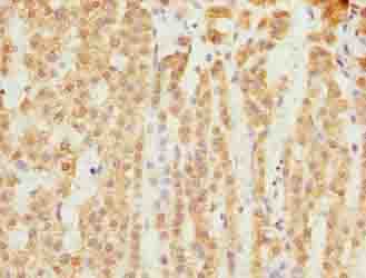 SLC25A18 Antibody