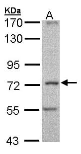 Polyclonal Rabbit anti-Human CILD9 / DNAI2 Antibody (aa382-605, WB)