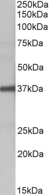 IHC-plus™ Polyclonal Goat anti-Human FUT2 / SE Antibody (aa27-40, IHC, WB)