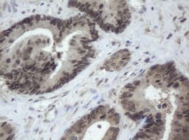 Monoclonal Mouse anti-Human CBX8 Antibody (clone OTI4H3, aa1-260, IHC, WB)
