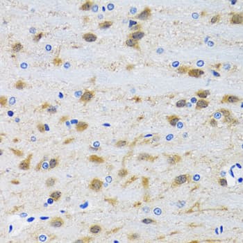 MAPK9 / JNK2 Antibody