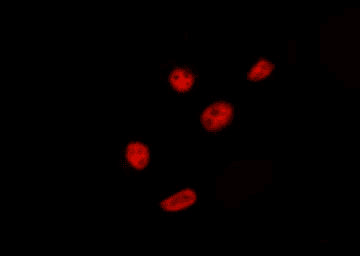 PRPF18 Antibody
