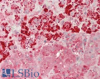 GLA / Alpha Galactosidase Antibody (aa81-429)
