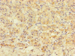 Polyclonal Rabbit anti-Human TAF13 Antibody