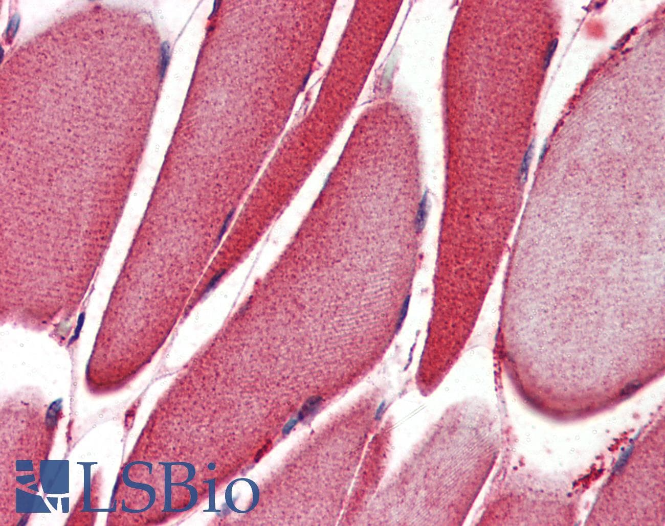 IHC-plus™ ALOX15 / 15-Lipoxygenase Antibody (aa482-494)