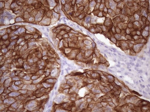 KRT16 / CK16 / Cytokeratin 16 Antibody (clone 7A4, Carrier-free)