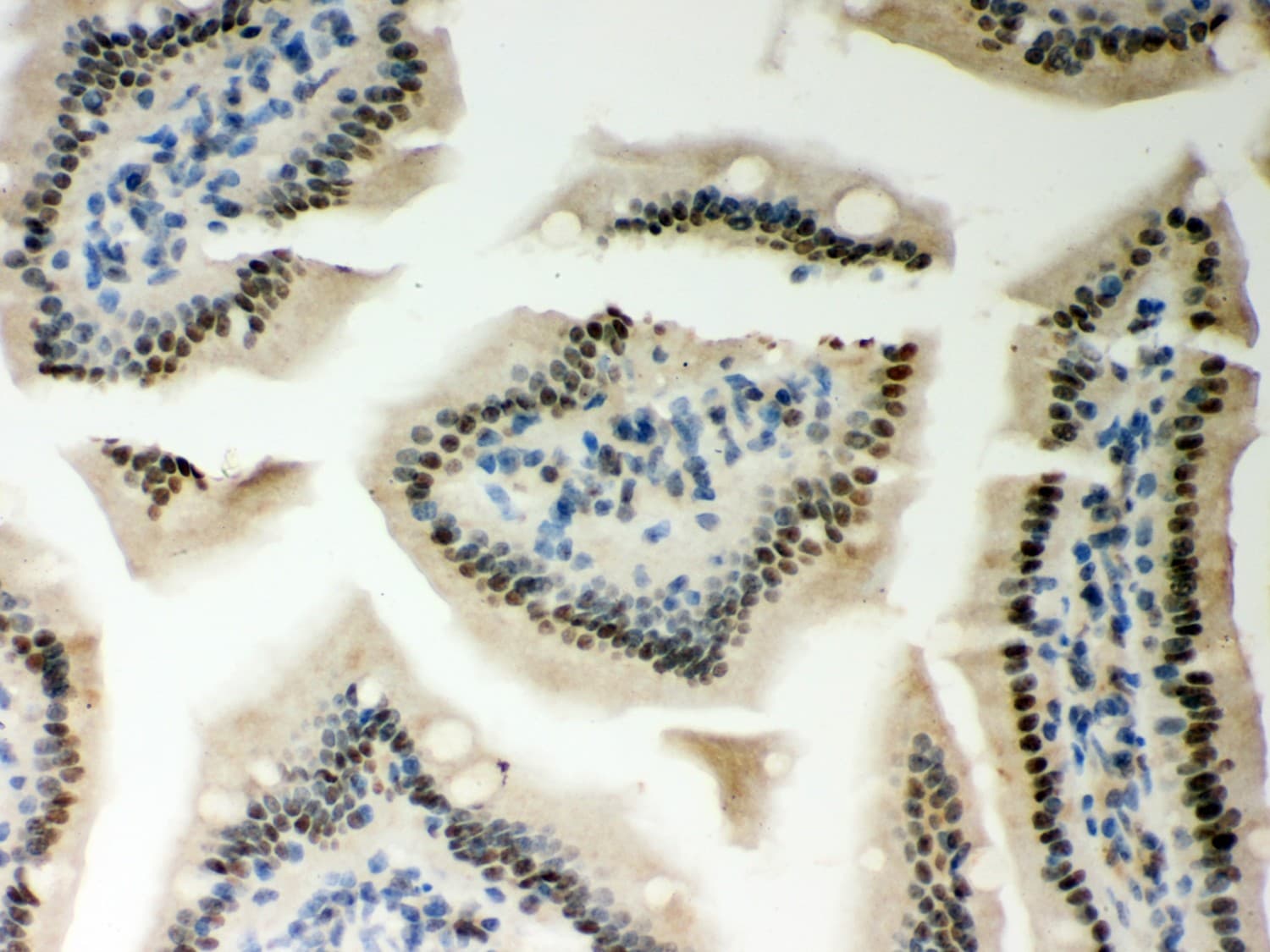PRKCE / PKC-Epsilon Antibody (aa53-236)