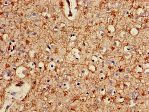 PSMA2 Antibody