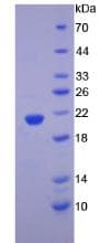 Human SPTAN1 / Alpha Fodrin Protein (Recombinant His, N-Terminal)