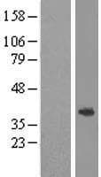 ABHD1 Protein (Over-Expression Lysate Myc-DDK (Flag))