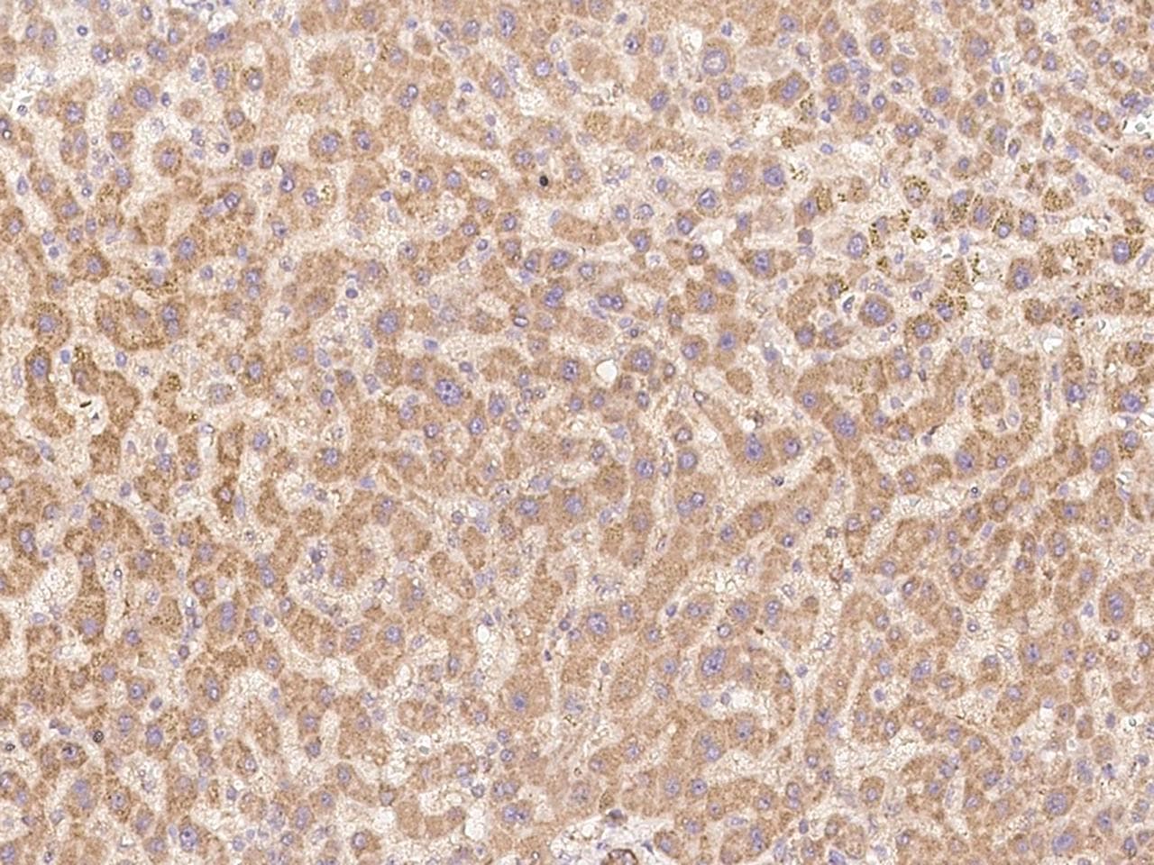 INHBB / Inhibin Beta B Antibody (Preservative Free)