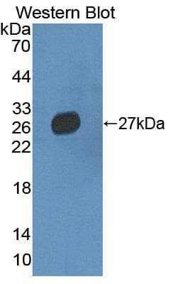 MMRN2 / Emilin 3 / EndoGlyx-1 Antibody (aa23-188)