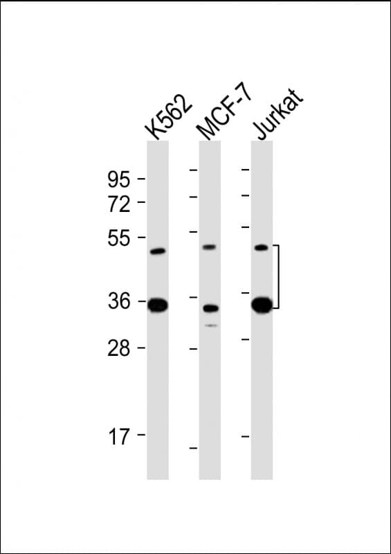 MBD2 Antibody (clone 1812CT625.9.45)