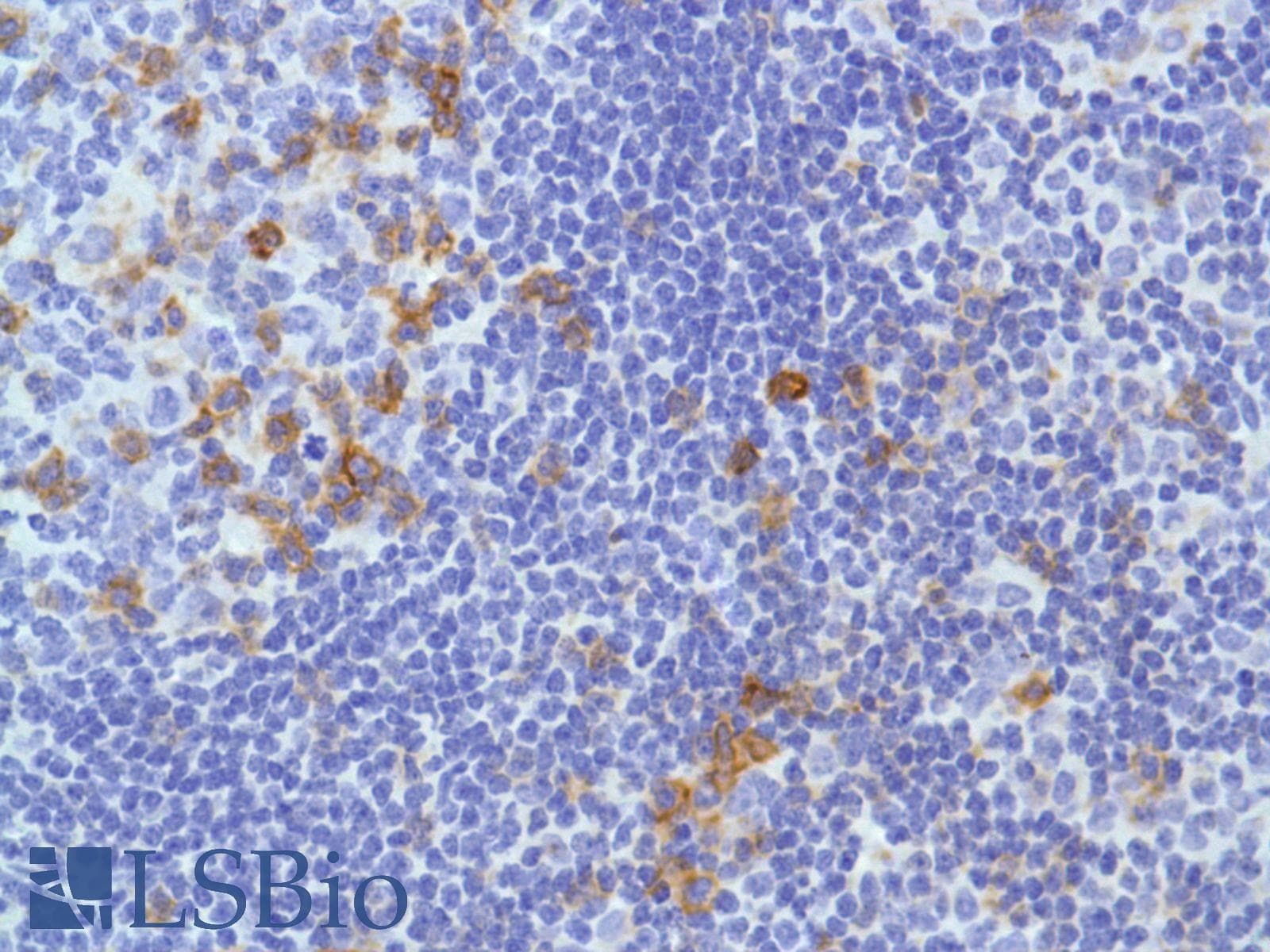 ICOS / CD278 Antibody (C-Terminus, clone SP98)