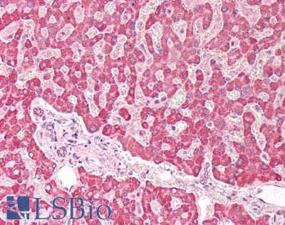 IHC-plus™ Polyclonal Goat anti-Human PLA2G2A / SPLA2 Antibody (IHC, WB)