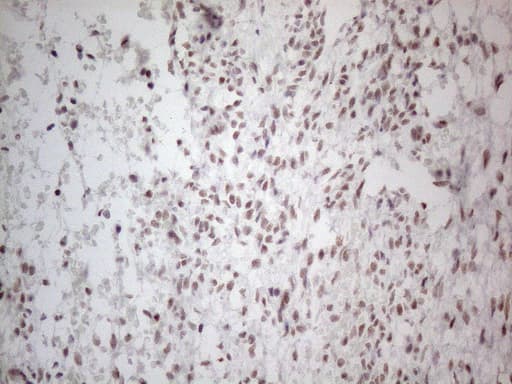 NR2C2 / TAK1 Antibody (aa1-241, clone OTI2H2)