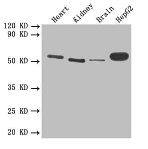 IHC-plus™ Polyclonal Rabbit anti-Human THBD / CD141 / Thrombomodulin Antibody (IHC, WB)