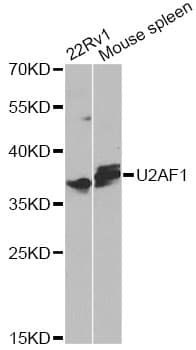 Polyclonal Rabbit anti-Human U2AF1 Antibody (IHC, WB)