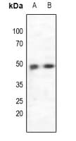 CCR5 Antibody