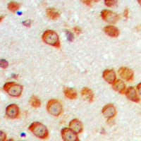 EPN3 Antibody (Internal)