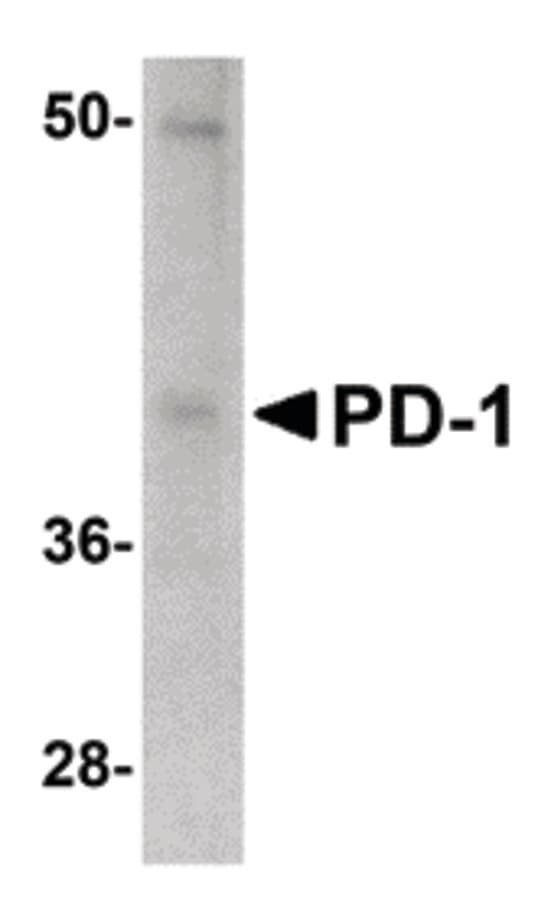 Monoclonal Mouse anti-Human PDCD1 / CD279 / PD-1 Antibody (clone 12A7D7, IHC, WB)